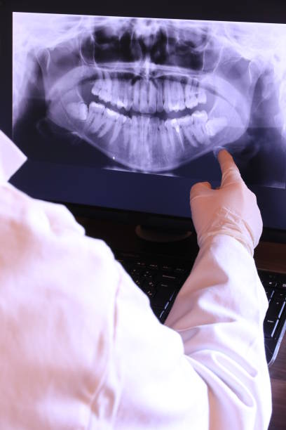 Best Emergency Dentist for Lost Fillings or Crowns in Rossvle, IL