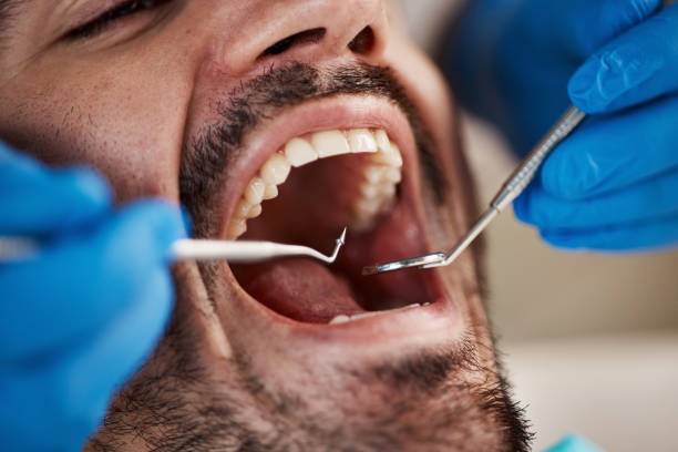 Best Urgent Dental Care for Toothache in Rossvle, IL