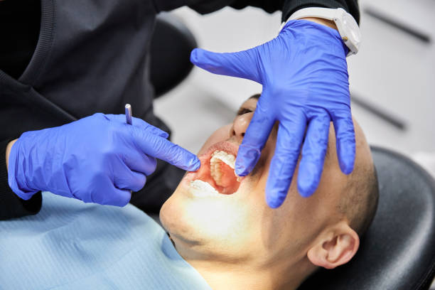 Best Emergency Root Canal Treatment in Rossvle, IL