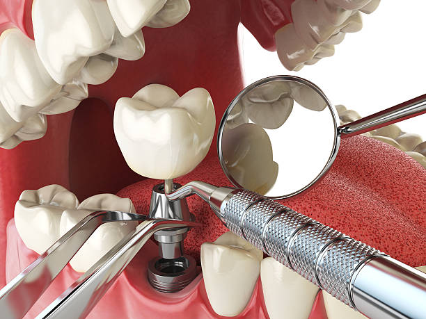 Best Emergency Dentist for Special Needs Patients in Rossvle, IL