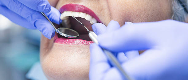 Best Emergency Dentist for Special Needs Patients in Rossvle, IL