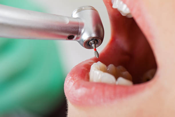 Best Mobile Emergency Dentist in Rossvle, IL